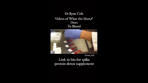 Dr Ryan Cole blood analysis of the shot