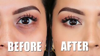 HOW TO CONCEAL DARK CIRCLES | TIPS ON HOW TO GET IT RIGHT!