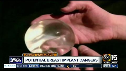 Woman talks about struggle with health after breast implants