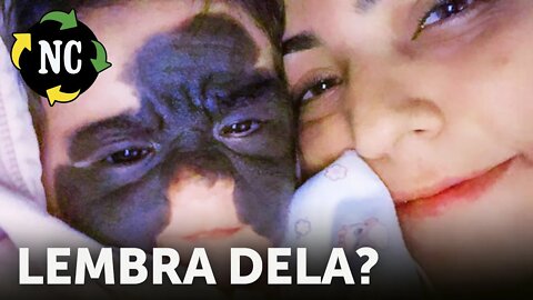 Lembra da filha deste casal com uma enorme mancha no rosto? Uma rápida mudança confortou à família