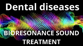 Dental diseases _ Bioresonance Sound Therapy _ Sounds of Nature