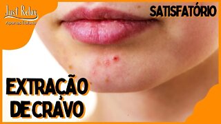 Só Relaxe Remoção de Cravos - Remove Blackheads and Pimples - Just Relax | Apenas Relaxe