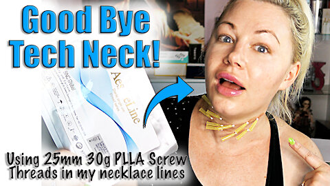 Goodbye Tech Neck - filling Necklace lines with PLLA Screw Threads| Code Jessica10 Saves you Money!