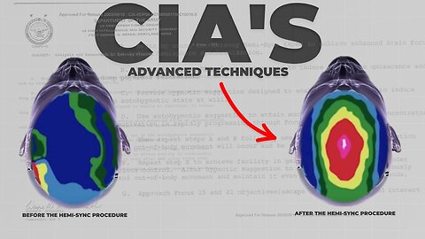 Brain Enhancement Techniques Listed In a CIA Document!