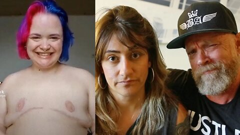 "Top Surgery Is For Anyone" TikTok Cringe : Trans Man & Lesbian React