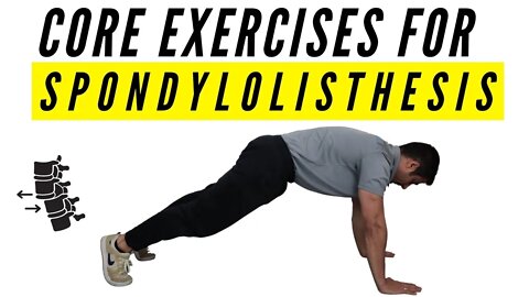 Core exercises for Spondylolisthesis