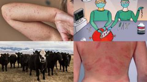 Covid Vaccines Contain Cow Protein That Triggers Deadly Meat Allergies!