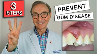 3 Easy Ways to Prevent Gum Disease at Home!