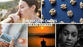 Study Shows Depression Causes Brain Shrinkage || Depression Leads to Brain Shrinkage