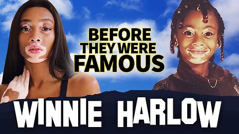 WINNIE HARLOW | Before They Were Famous | Biography