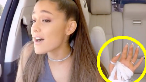 How Ariana Grande Got Injured During Carpool Karaoke Taping