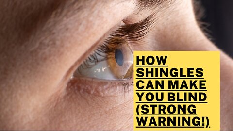 How Shingles Can Make You Blind (Strong Warning!)