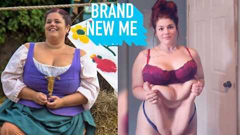 My 200lb Weight Loss Left Me With 15lbs Of Excess Skin | BRAND NEW ME
