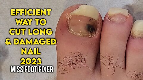 "Efficient Techniques for Foot Nail Cutting and Cleaning" By famous feet Specialist miss foot fixer