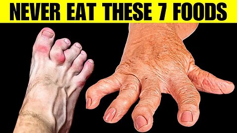 Arthritis! Warning, (NEVER Eat These 7 Foods😱) #arthritis| True Facts