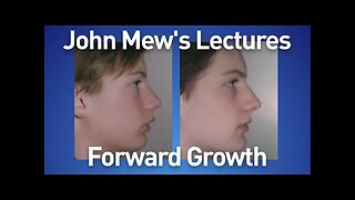 John Mew's lectures part 19: Forward Growth