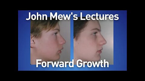 John Mew's lectures part 19: Forward Growth