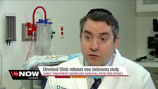First of its kind study by Cleveland Clinic highlights importance of early melanoma treatment