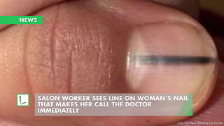 Salon Worker Sees Line on Woman’s Nail That Makes Her Call the Doctor Immediately