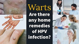 All you wanted to know about HPV infection