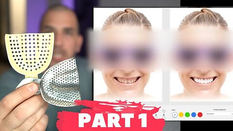 Porcelain Veneers Procedure | Digital Design App to Visualize Smile Makeover!