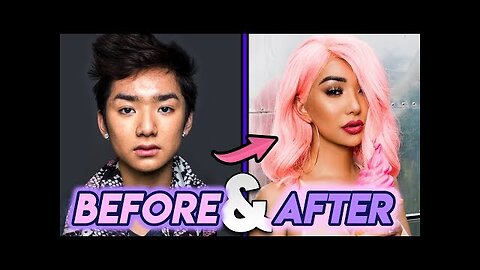 Nikita Dragun | Before and After Transformations | Trans YouTuber Plastic Surgery Transformation