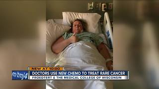 Delavan woman finds 30 pounds of tumors in her stomach