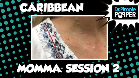 Caribbean Momma Steatocystomas: Session Two, Part One