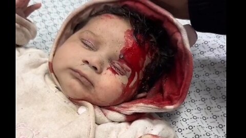 Baby Severely Injured by Occupation Forces