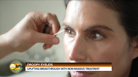DROOPY EYES - NON INVASIVE TREATMENT