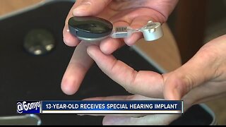 13-year-old girl receives new hearing implant technology, first in Idaho