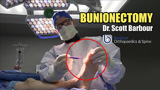 BUNIONECTOMY