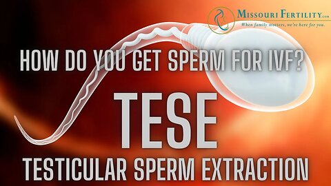 TESE: Getting Sperm for IVF