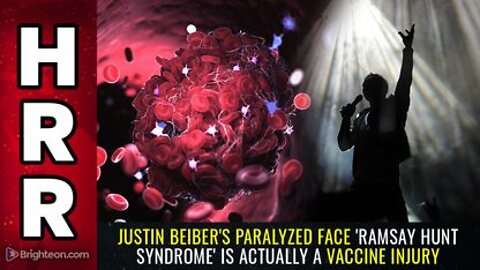 06-12-22 S.R. - Justin Beibers PARALYZED Face Ramsay Hunt Syndrome is actually a VACCINE INJURY