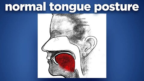 Normal Tongue Posture by Prof John Mew