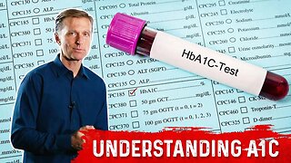 What is A1C Test? Is it an Accurate Blood Test? – Dr.Berg