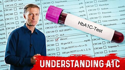 What is A1C Test? Is it an Accurate Blood Test? – Dr.Berg