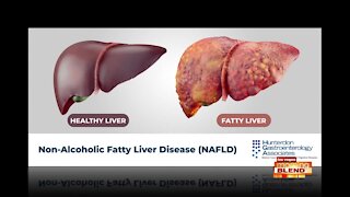 How a Fatty Liver Stops Weight Loss