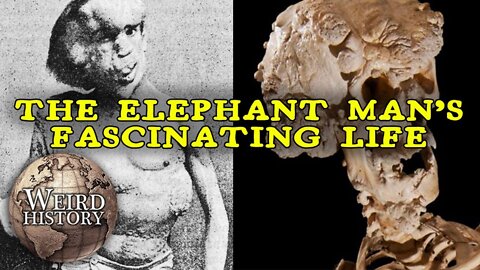 The Elephant Man - The Weird & Tragic Story of Joseph Merrick