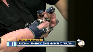 Prosthetic giving new hope to amputees