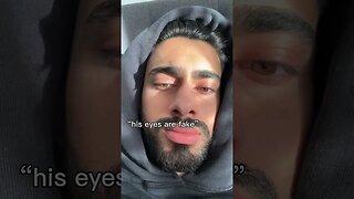 “his eyes are fake”