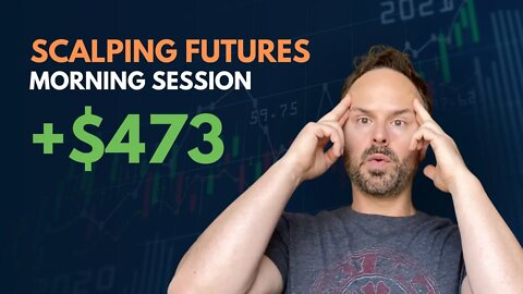 WATCH ME TRADE | +$473 WIN | DAY TRADING Nasdaq Futures Trading Scalping Day Trading