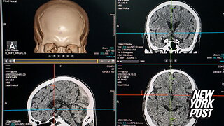 These 5 jobs put workers at a greater risk of dementia: new research