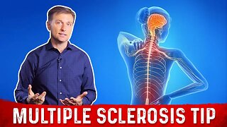 Multiple Sclerosis: What Causes MS and What to Do if You Have this