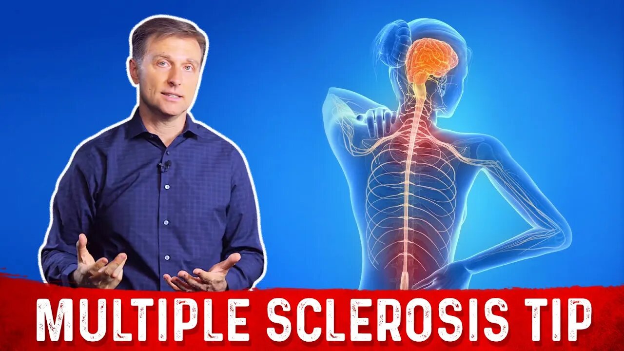 Multiple Sclerosis What Causes MS And What To Do If You Have This multiple-sclerosis-what-causes-ms-and-what-to-do-if-you-have-this