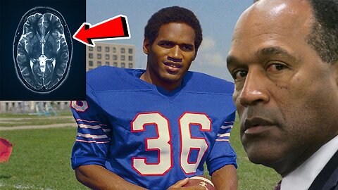 NFL fans FURIOUS after final decision made on OJ Simpson's brain!