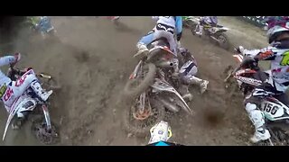 INSANE dirtbike rider foot injury! (WOW)