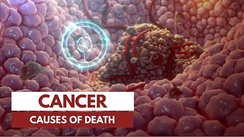 How does a person die from cancer? | 3D Animation