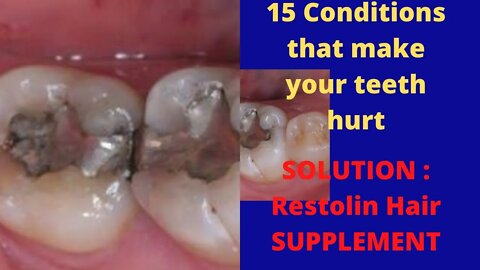 Dental Care : 15 Conditions That Make Your Teeth Hurt