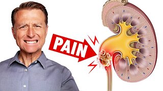 The Most PAINFUL Thing is a Kidney Stone - Dr. Berg